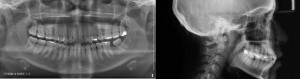 Clinica Mariana sacoto Navia Expertos en ortodoncia invisalign Barcelona